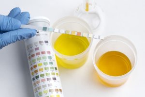 Можно ли сдавать анализ мочи при месячных