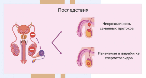Что такое &laquo;мужская эякуляция&raquo;, как происходит, коррекция оргазма