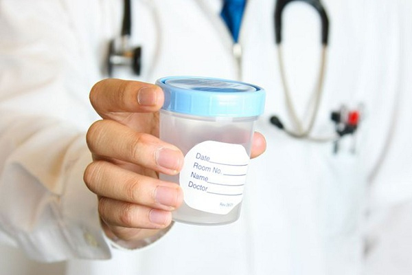 Желтая сперма у мужчин &mdash; причины и необходимость лечения