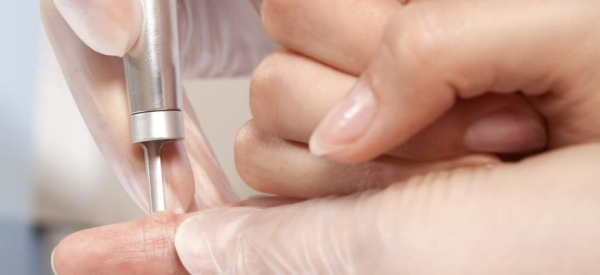 Как обрабатывать бородавку после прижигания азотом