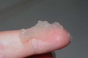 Густая сперма в виде желе: причины и лечение у мужчин