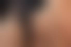 Нитроглицериновая мазь &mdash; применение для восстановления потенции