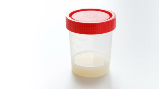 Жидкая сперма прозрачного цвета: что значит, нормально ли это, так бывает