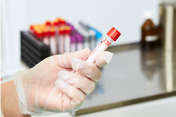 Можно ли сдавать анализ мочи при месячных