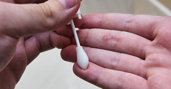 Как удалить бородавки между пальцами ног