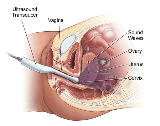 На УЗИ видна эрозия шейки матки или нет?