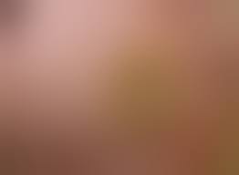 После удаления подошвенной бородавки не заживает рана, что делать