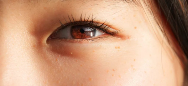 Уход за раной после операции по удалению папилломы