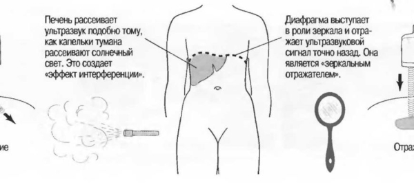 Правильная пальпация поджелудочной железы: основные рекомендации