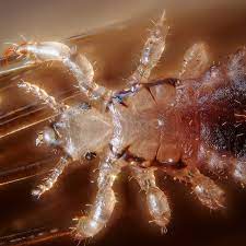 Способы передачи паразитов: прыгают ли вши