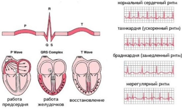 Перебои в сердце: причины, норма и патология, лечение