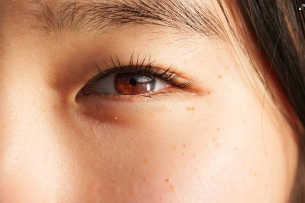 Уход за раной после операции по удалению папилломы