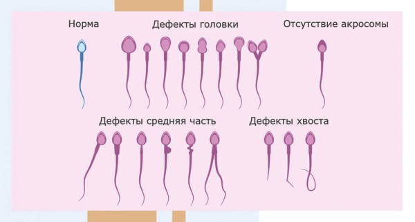 Улучшение качества спермы у мужчин: 10 подходов и методов