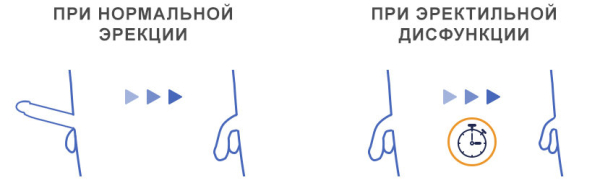 Контроль эрекции &ndash; как мужчине научиться управлять возбуждением