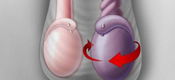 Одно яичко висит ниже другого &ndash; о чем это свидетельствует