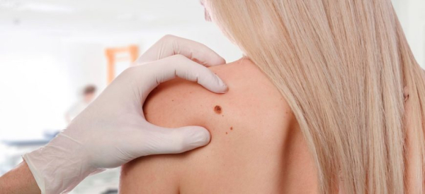 К какому врачу обратиться при папилломах