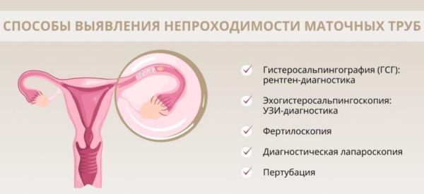 Спаечная болезнь брюшной полости: причины, симптомы, диета, лечение