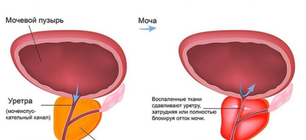 Лен &mdash; народное средство для потенции проверенное временем