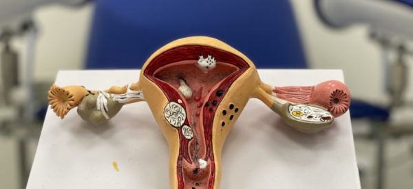 Лечение кисты на шейке матки