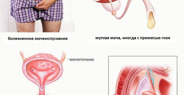 Можно ли заразиться хламидиозом через слюну?