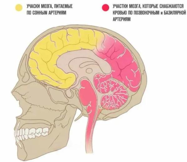 Способы лечения нарушения мозгового кровообращения при шейном остеохондрозе
