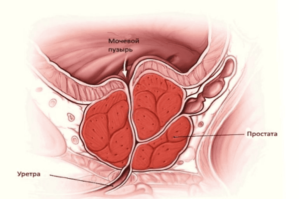 Определение простатита и лечение с помощью ромашки: отвары и клизмы для мужчин