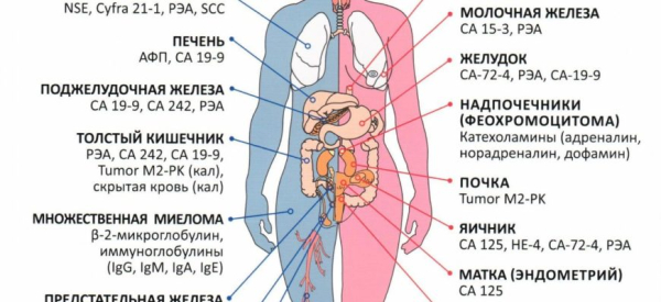 Что такое онкомаркеры и какие бывают