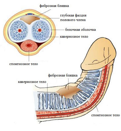 Болезнь Пейрони &ndash; причины, симптомы и лечение