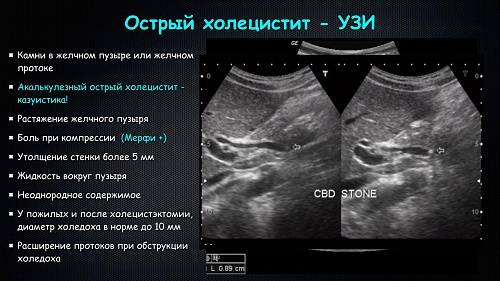 Правильная пальпация поджелудочной железы: основные рекомендации