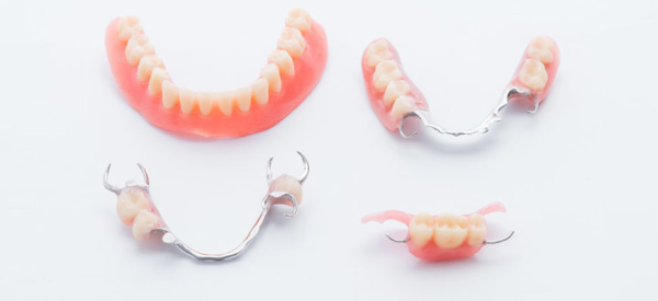 Классификация методик протезирования зубов и выбор лучшего зубного протеза