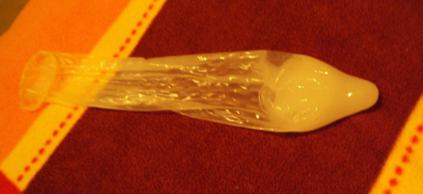 Желтая сперма у мужчин &mdash; причины и необходимость лечения