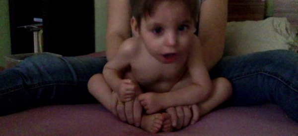 Лиссэнцефалия &mdash; есть ли шанс, если у ребенка &laquo;гладкий&raquo; мозг