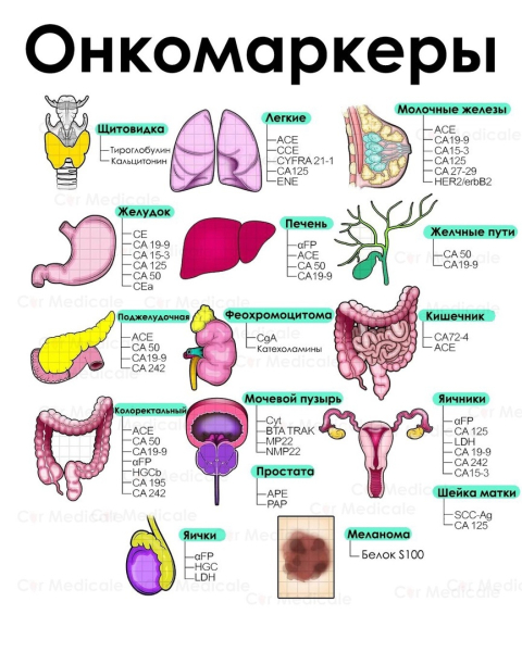 Что такое онкомаркеры и какие бывают