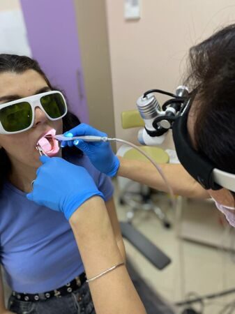 Причины и лечение папилломы на миндалине у ребенка