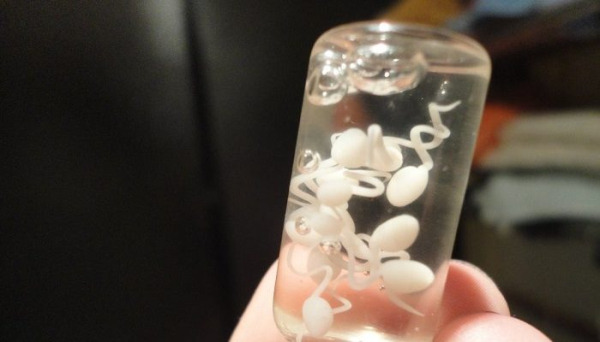 Жидкая сперма прозрачного цвета: что значит, нормально ли это, так бывает