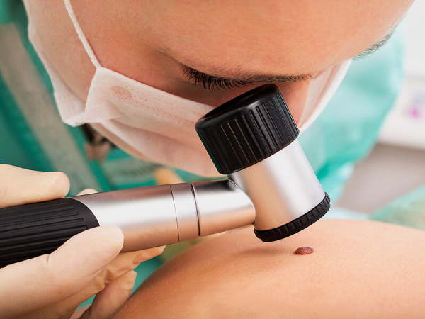 Папиллома на внутренней стороне бедра: причины и лечение