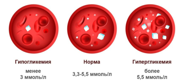 Гликемия: понятие, уровень в норме и нарушения, диагностика, лечение отклонений