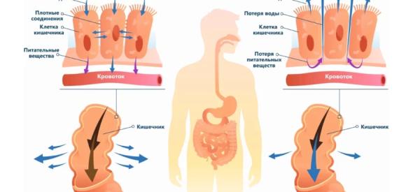 Понос после употребления алкоголя: причины и лечение диареи