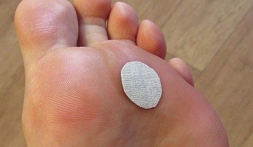 Вирусная бородавка на ноге: причины, симптомы и лечение