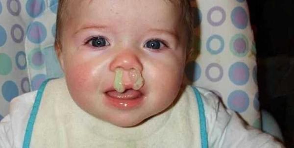 Стафилококк золотистый ауреус &mdash; симптомы и лечение