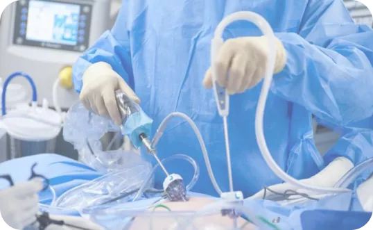 Удаление почки посредством лапароскопического метода