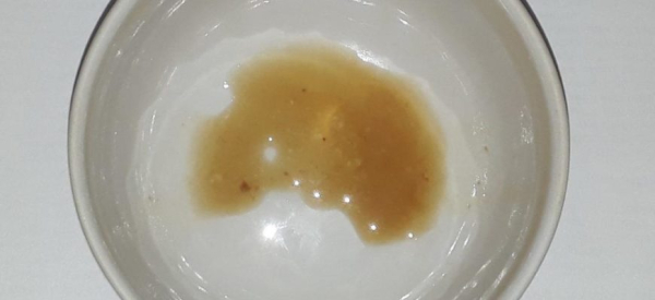 Коричневая сперма у мужчин: причины и лечение