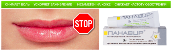 Герпес на горле у ребенка &ndash; лечение: 16 лекарственных средств