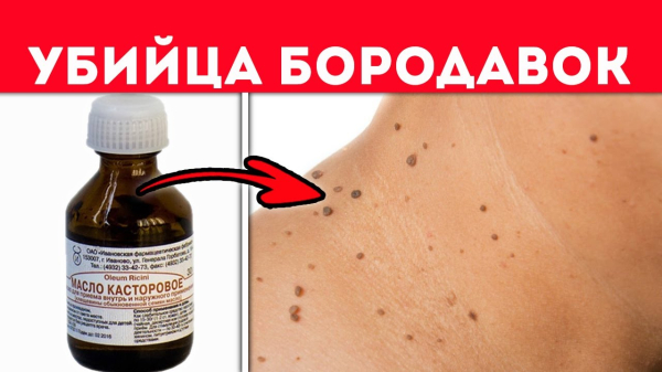 Камфорное масло против бородавок: применение и отзывы
