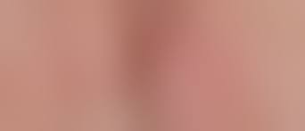 Папилломы на половых губах при беременности: симптомы и лечение