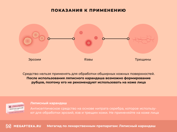 Ляписный карандаш от папиллом и бородавок: инструкция по применению, отзывы