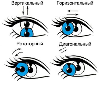 Нистагм или тремор глаз: причины, симптомы, лечение