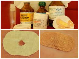 Нашатырный спирт против папиллом: особенности лечения