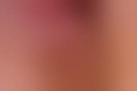 Бородавки на интимных местах у женщин: симптомы и лечение