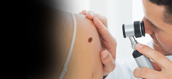 Сколько длится боль в горле после удаления папиллом?